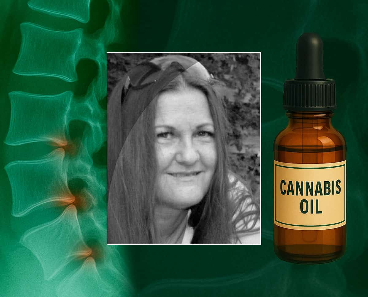 Heidi fick vänta i tolv år på en diagnos – medicinsk cannabis gav henne livet tillbaka